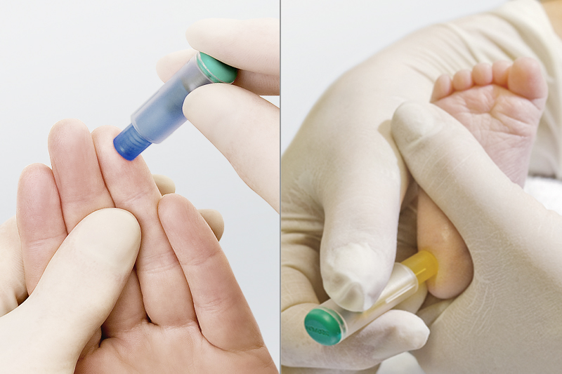 Typical Steps of Capillary Blood Collection