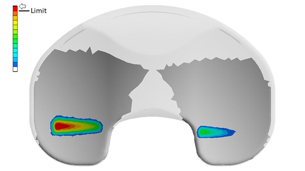 The pressure of the implant is shown on the display