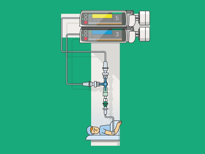 A letter T formed by various medical devices