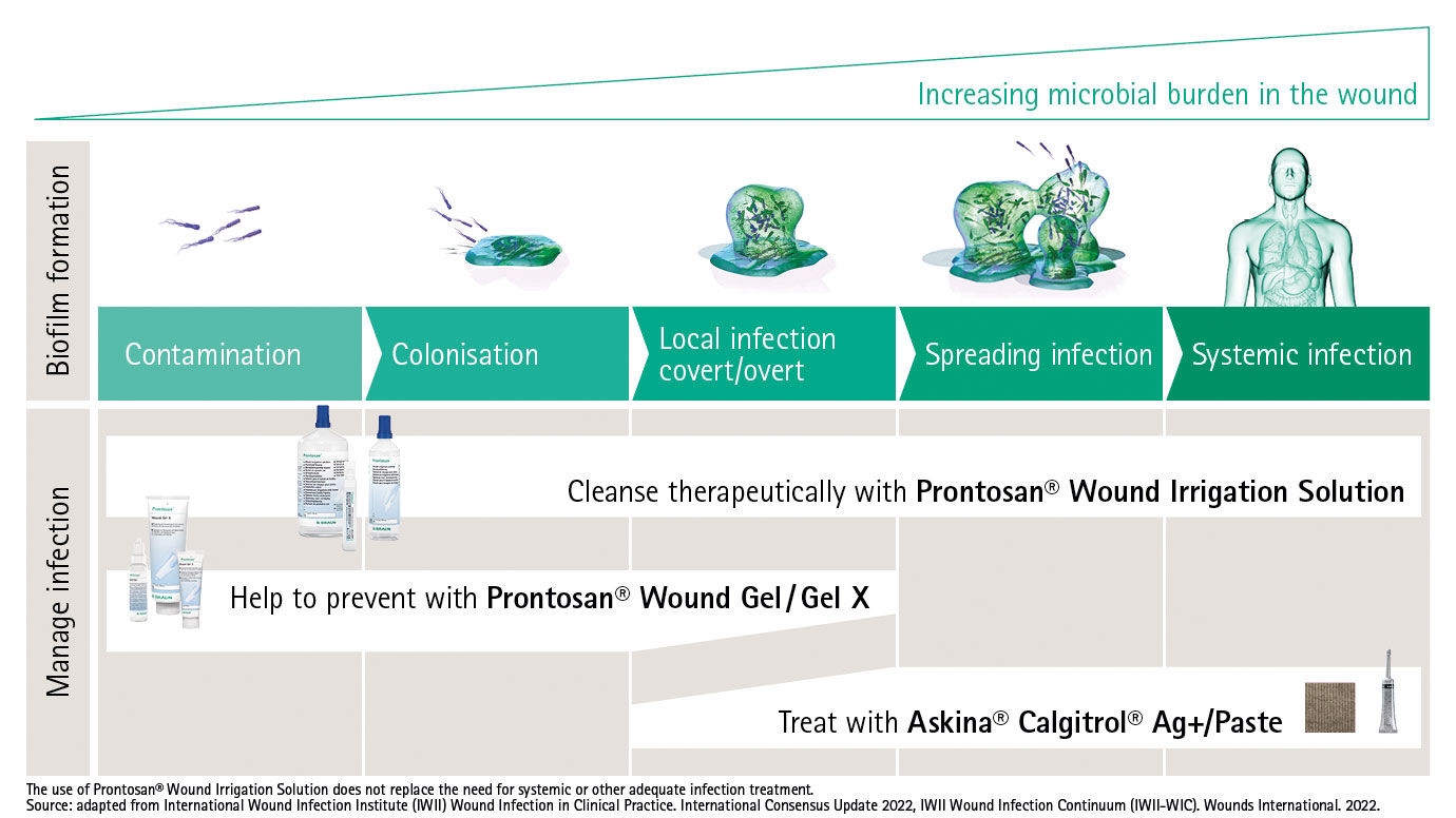 Graphic showing all stages of the wound infection continuum and treatment mit Prontosan and Askina Calgitrol