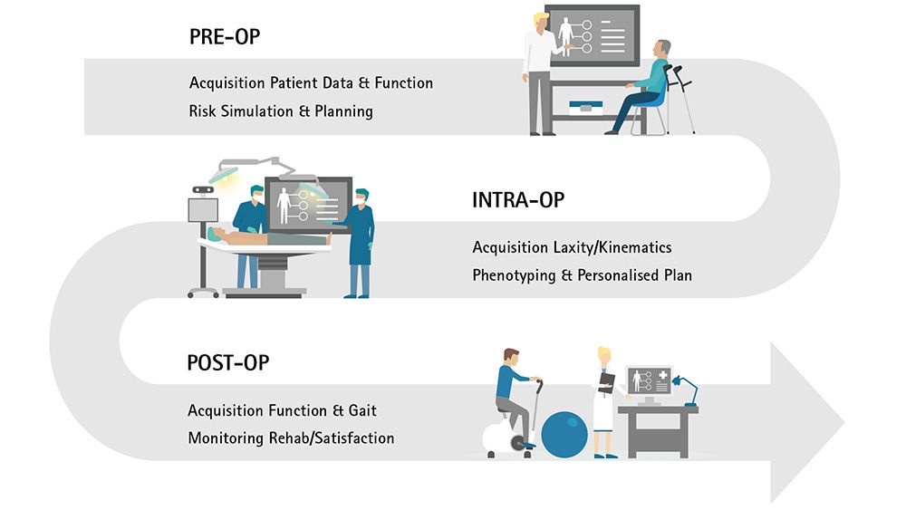 A process image in which the pre-op starts with acquisition patient data & function and risk simulation & planning, where a doctor and a patient can be seen receiving information. The process continues with the intra-op and acquisition laxity/kinematics and phenotyping & personalized plan, here a patient can be seen on the operating table next to two doctors. The last phase is the post-op phase with the acquisition function & gait and monitoring rehab/satisfaction, here you can see a patient on a stationary bike and an exercise ball, next to a doctor who is recording it.